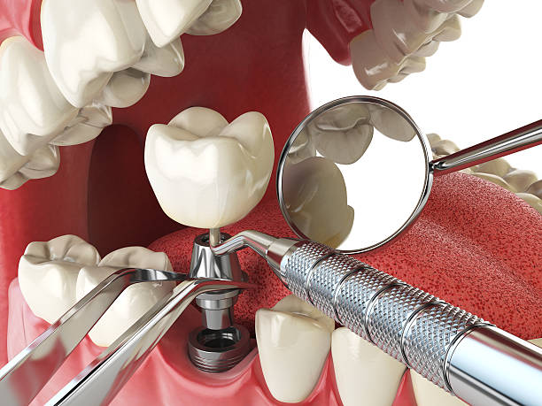Best Broken Tooth Emergency  in Wood Ridge, NJ